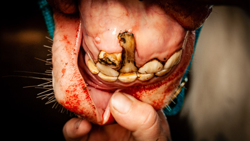 Incisor Trauma