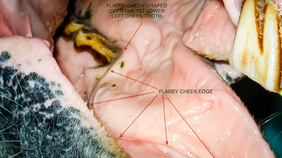 Flabby Cheeks Of The Oral Cavity