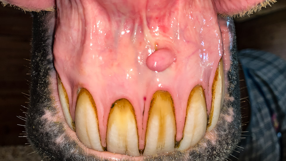 Oral Cavity Growths