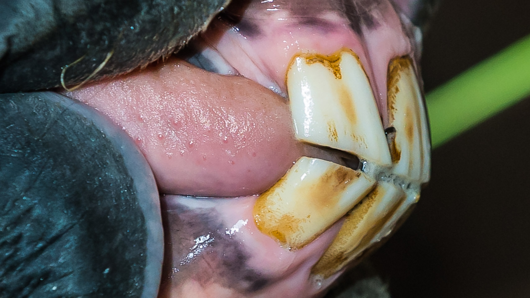 Aging By Teeth – View Right Side